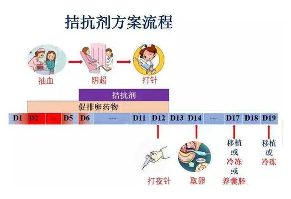 试管拮抗剂方案优点缺点