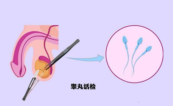 高促性无精症注射促性腺激素有效果吗?是最新治疗方案吗?