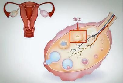 卵巢黄体破裂如何治疗?卵巢黄体破裂的3治疗方法揭晓!