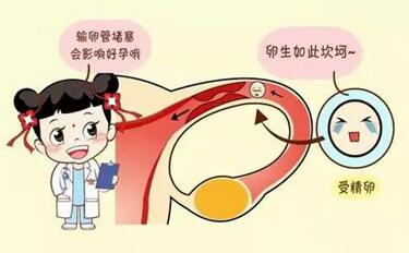 输卵管肿瘤是什么原因引起的?输卵管肿瘤能治愈吗?