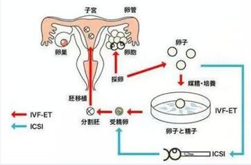 试管婴儿原理