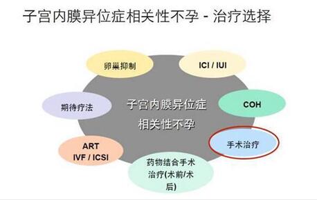 子宫内膜异位症如何诊断?子宫内膜异位症想怀孕怎么治疗?