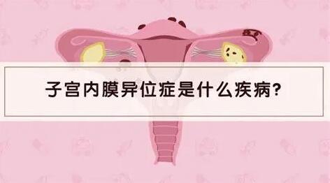 子宫内膜异位症如何诊断?子宫内膜异位症想怀孕怎么治疗?