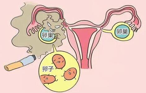 卵巢早衰会导致卵巢癌吗?治疗卵巢早衰的中成药!