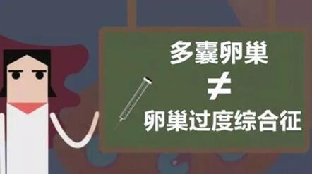 治疗多囊卵巢或排卵障碍性如何避免卵巢过度刺激征?