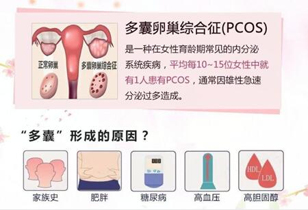 多囊卵巢综合征怎么进行确诊?多囊会对生育有影响吗?