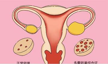 多囊卵巢患者促排卵怀孕成功率高吗?怎么治疗促排期间吃什么药物?