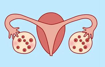 多囊卵巢严重吗需要去治疗吗?多囊卵巢怎么调理才能好?