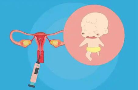 不孕不育可以做人工受孕吗?人工授精的全部过程是什么?
