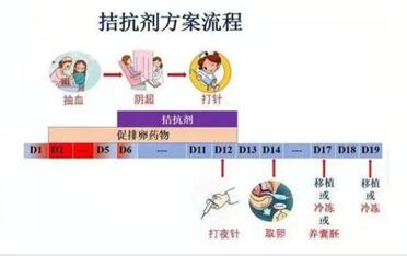 试管婴儿拮抗剂方案是什么?拮抗剂方案适合的人群?