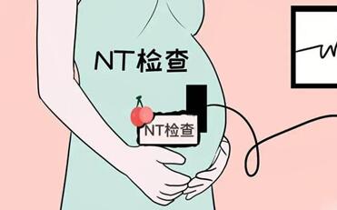 nt小于1.5就一定是女孩吗?产检nt值小于1.5是女孩可信吗?