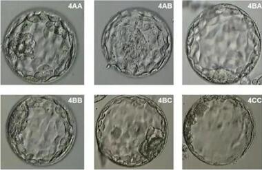 6天的4BC囊胚几天着床?一个囊胚最晚几天着床?
