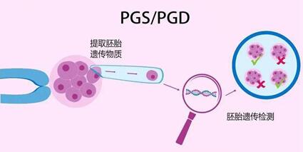 要想做试管婴儿,北医三院和协和三代试管哪个更好?