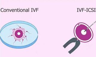 试管ICSI与IVF区别是什么?孰高孰低还真不好说!