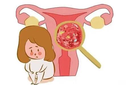 子宫内膜炎导致子宫腺肌症,用这些方法能有效帮你!