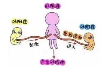 新生儿溶血症是什么原因?掉以轻心会出现大问题!