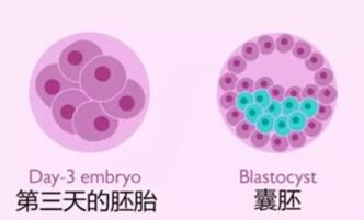试管婴儿胚胎移植和移植囊胚的区别是什么?