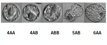 盘点4aa和4bb胚胎的区别,看完就知道如何选择!