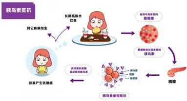 胰岛素抵抗对试管移植的影响,这四大改善方法可有效改善!