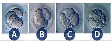 试管婴儿胚胎碎片多怎样改善?提前解决问题以免过于紧迫