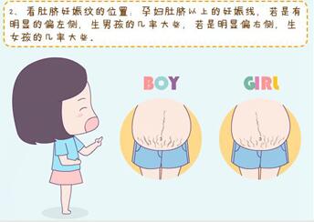 妊娠纹判断生男生女准确吗?怎么通过妊娠纹判断胎儿性别?