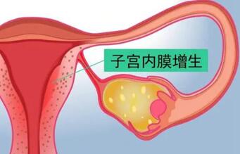 试管长方案子宫内膜增厚原因分析,主要和促排药物有关