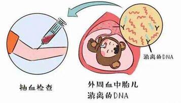 胎儿DNA浓度低是什么原因?dna浓度低胎儿还能要吗? 