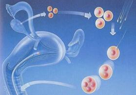试管婴儿取5个卵泡能成功吗?75%的可能性会被精子受精