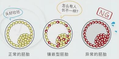 做三代试管培养出来嵌合体胚胎怎么办?应及早的处理掉