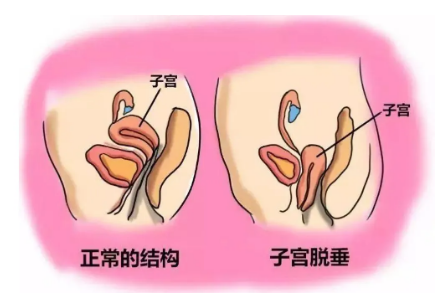 子宫内膜0.5cm正常吗