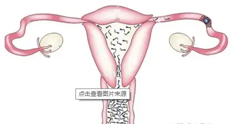 输卵管内径多少mm才正常