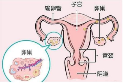 卵巢早衰的性激素指标